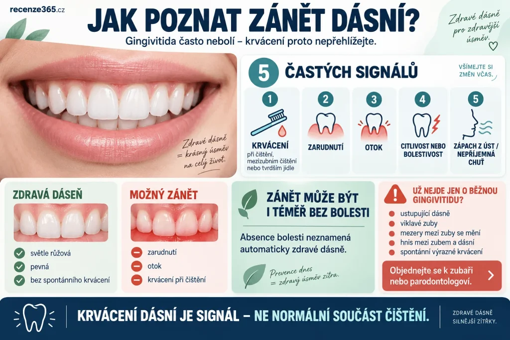 Jak poznat zánět dásní – příznaky gingivitidy, krvácení při čištění zubů, červené oteklé dásně, bolest a citlivost dásní, zápach z úst, krvácení při mezizubním čištění a příznaky onemocnění dásní.
