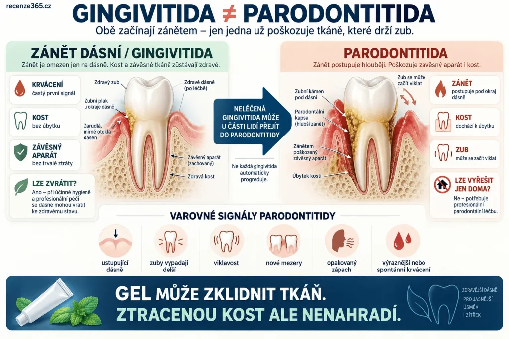 Zánět dásní versus parodontitida – rozdíl mezi gingivitidou a parodontózou, krvácení dásní, zubní plak, parodontální kapsy, úbytek kosti, ustupující dásně, viklavé zuby a léčba parodontitidy.